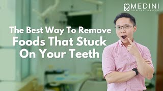 The Best Way To Remove Foods That Stuck On Your Teeth