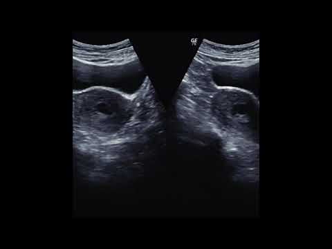 02. Forested - . [20.12.2019]