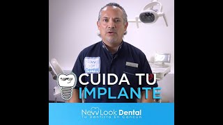 ¿Qué comer después de un implante dental Sepa que alimentos son recomendables para el pós implante