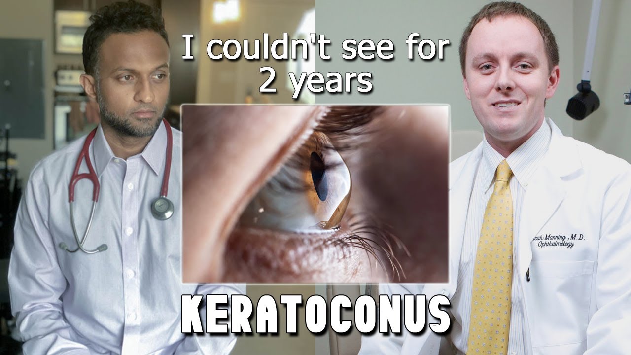 Why I Couldn't See For 2 Years - Keratoconus | My Story and Keratoconus FAQ