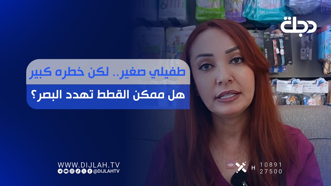 فيديو | طفيلي صغير.. لكن خطره كبير هل ممكن القطط تهدد البصر؟