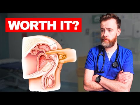 1000 Prostatauntersuchungen später... Der Fingertest enthüllt
