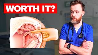 1,000 Prostate Exams Later... The Finger Test Exposed
