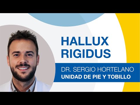 Hallux Rigidus: qué es y tratamiento