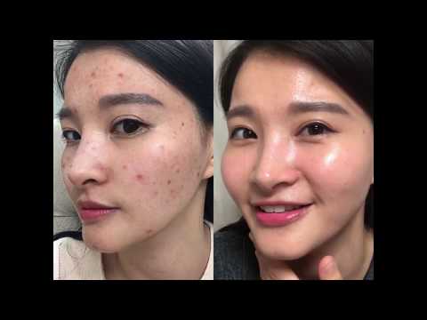 Some By Mi AHA BHA PHA 30 Days Miracle Serum