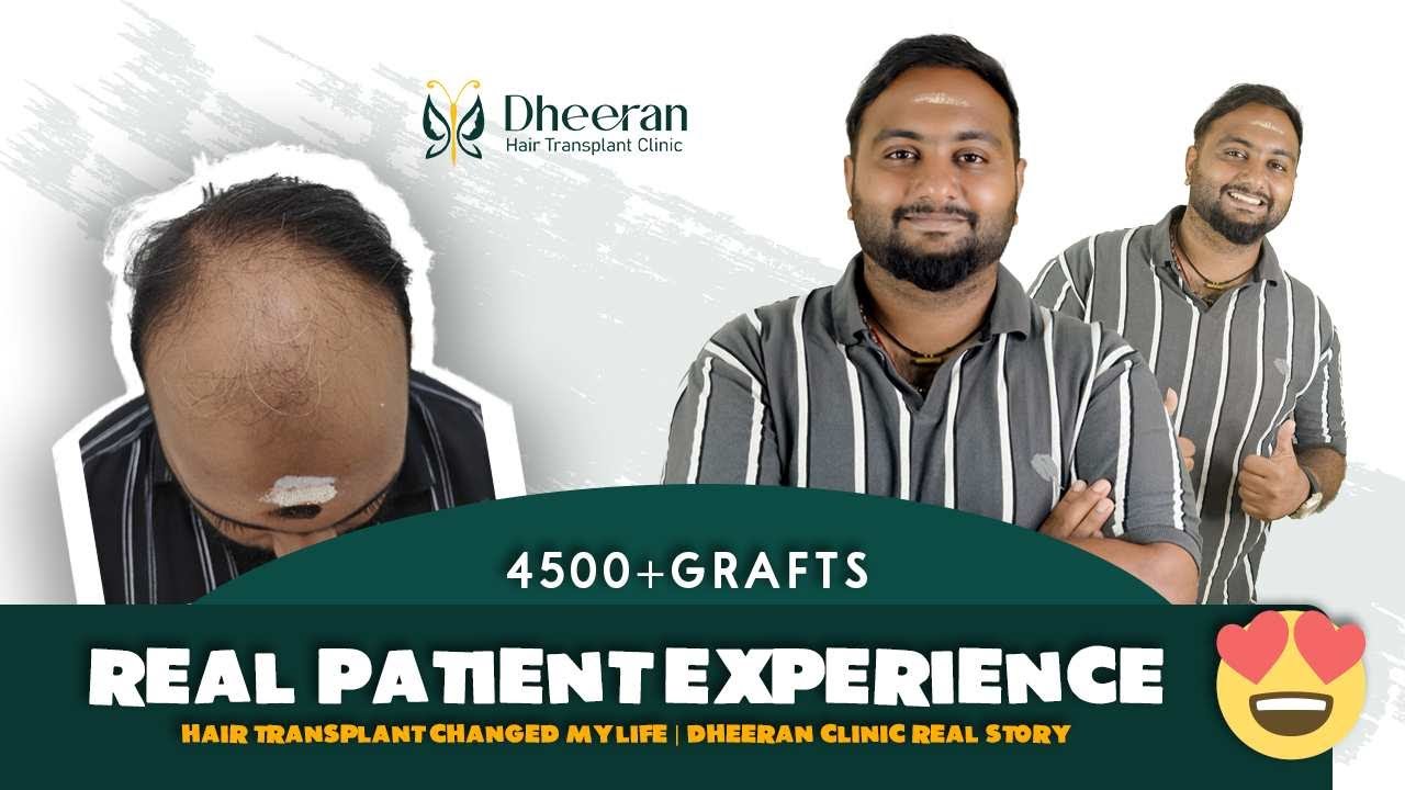 Dheeran Clinic Hair Transplant Result Video