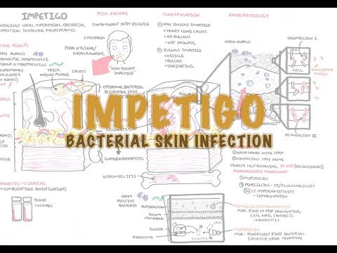 Impetigo Bacterial Skin Infection - Overview