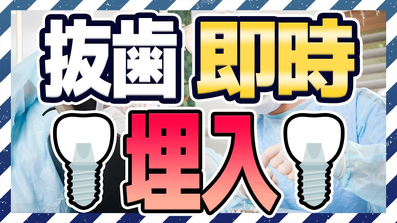 インプラント手術方法のひとつ、抜歯即時埋入とは?