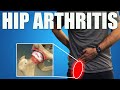 HIP OSTEOARTHRITIS.  BEST Exercises, Stretches & Advice for Hip & Groin Pain Relief