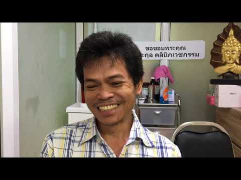 กลากบนใบหน้าของเด็ก กลากแพ้เป็น