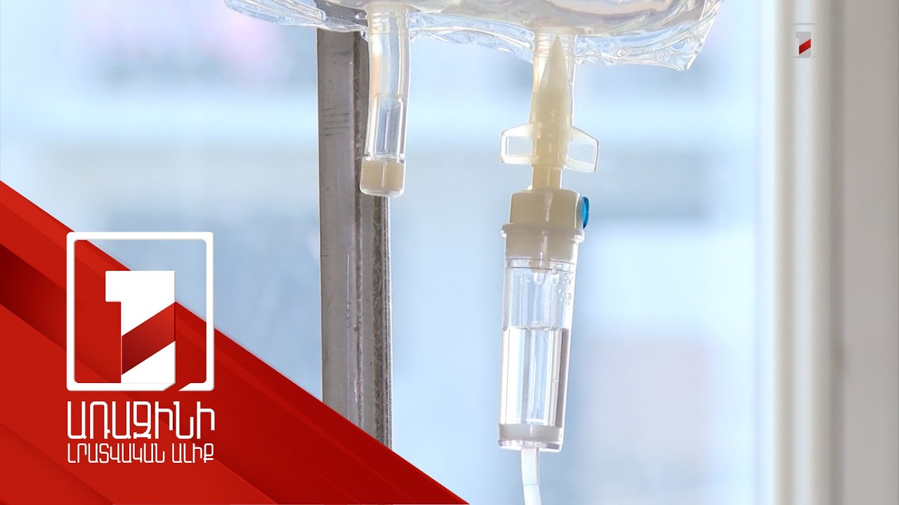 Տարեկան 3000-ից ավելի այրվածքի դեպք՝ մեծ մասը երեխաներ