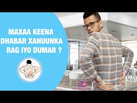 DHABAR XANUUNKA WAXA SABABO IYO SIDA LOOLA TACAALO. Dr faris Alattas