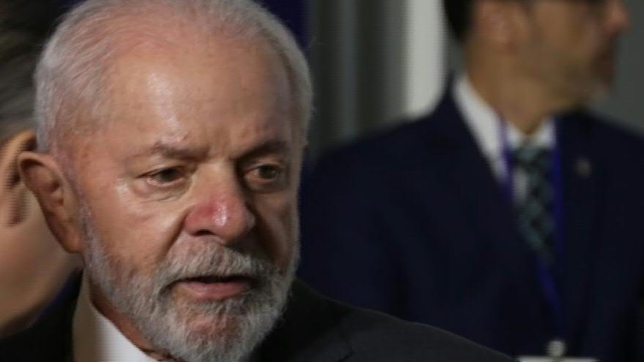 Lula teve o dreno intracraniano retirado | AFP