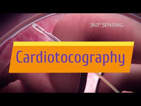 Cardiotocography Trailer