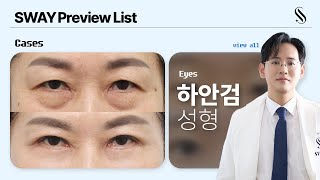 EYES PREVIEW. 처지고 울퉁불퉁한 눈밑? | #하안검 #리프팅