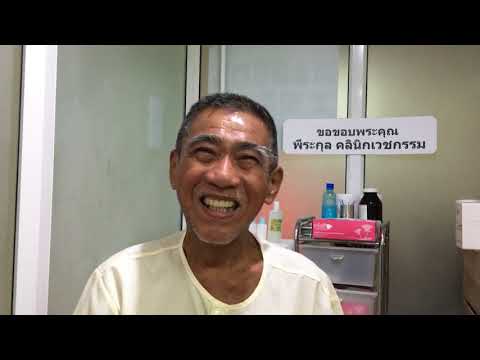 รหัสโรคสะเก็ดเงิน mb 10 ASD-2 การตอบสนองในโรคสะเก็ดเงิน