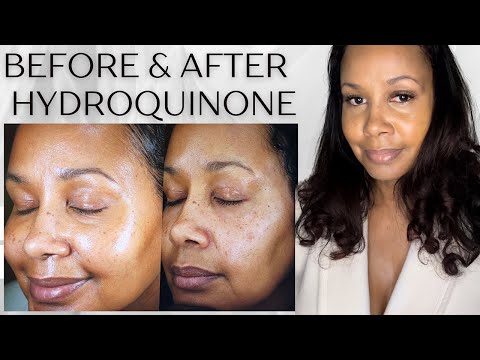 Demelan cream usp, packaging size: 20gm