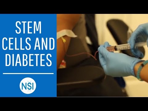 How Can Stem Cells Treat Diabetes? | NSI Stem Cell