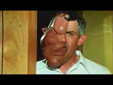 Being Different (1981) ORIGINAL TRAILER