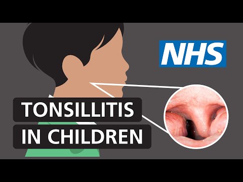 Tonsillitis in children: Symptoms and treatment | NHS
