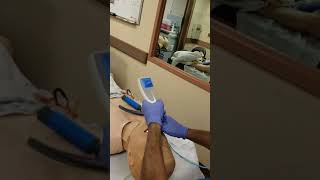 Ambu's I-view used as a direct laryngoscope. D-looped bougie in an ETT.