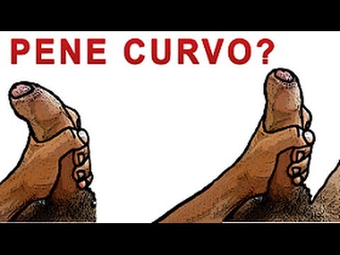 Recensioni di volpe argentata patogeno femminile Galangal radice per la potenza