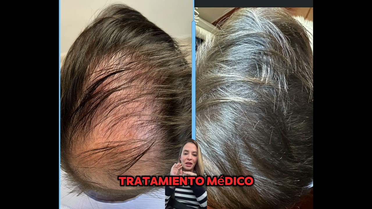 Victoria Trasmonte-150