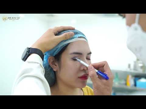 Sự thật phía sau những ca mí lỗi hỏng…