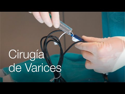Varicose Vein Surgery: What Are the Risks? What's the Postoperative Period Like?