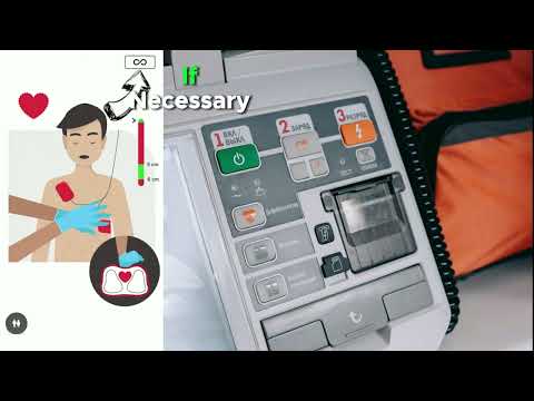 What is pacemaker how to work and Working Principle Advantage and Disadvantage