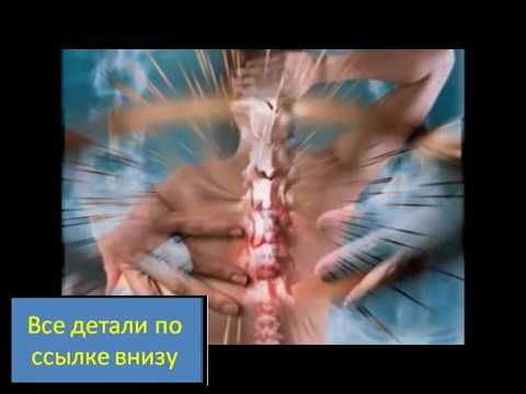 Чем лечить деформирующий артроз коленного сустава 3 степени лечение Лечение посттравматического артроза коленного сустава