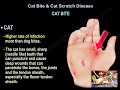 Cat Bite Cat Scratch Disease Everything You Need To Know Dr Nabil Ebraheim