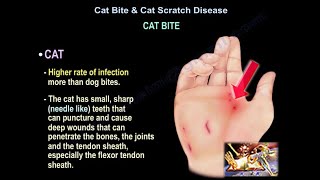 Cat Bite & Cat Scratch Disease - Everything You Need To Know - Dr. Nabil Ebraheim