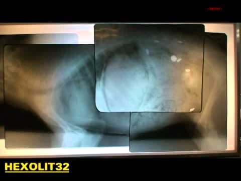 DDupleks Hexolit 32 in action