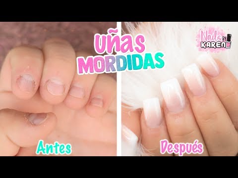 UÑAS MORDIDAS | Onicofagia CAMBIO TOTAL!!