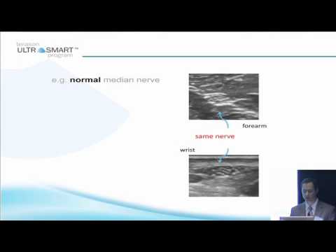 Terason's MSK Ultrasound Basics with Dr. Visco: Part 5 of 8