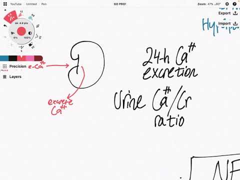 Approach to Hypercalcemia-2 and differential diagnosis