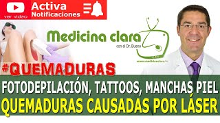 QUEMADURAS por LÁSER en FOTODEPILACIÓN y ELIMINACIÓN DE MANCHAS Y TATUAJES | MEDICINA CLARA