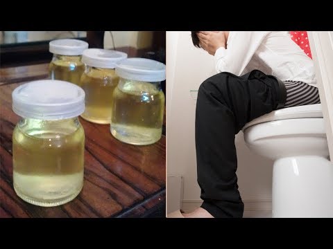 2 Ways To Cure Completely Hemorrhoids With Coconut Oil Afer A Week, Get Rid Of Hemorrhoids Naturally
