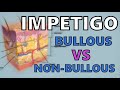 IMPETIGO EXPLAINED IN 2 MINUTES - BULLOUS vs NON-BULLOUS IMPETIGO