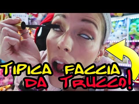 Ci sono posti di pigmentary a neonati Quello che è necessario da posti di pigmentary