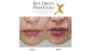 Miniature de la vidéo