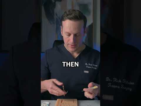 The simple continuous stitch (AKA baseball stitch) #doctor #surgery #sutruing #stitches #medicine