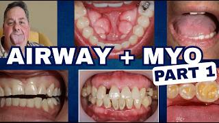 Implementing Sleep, Airway and Myo to Restorative Dentistry Part 1 - PDP262