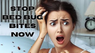 How To Stop Bedbugs Bites