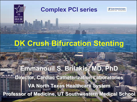 How to perform the DK crush technique for bifurcation stenting