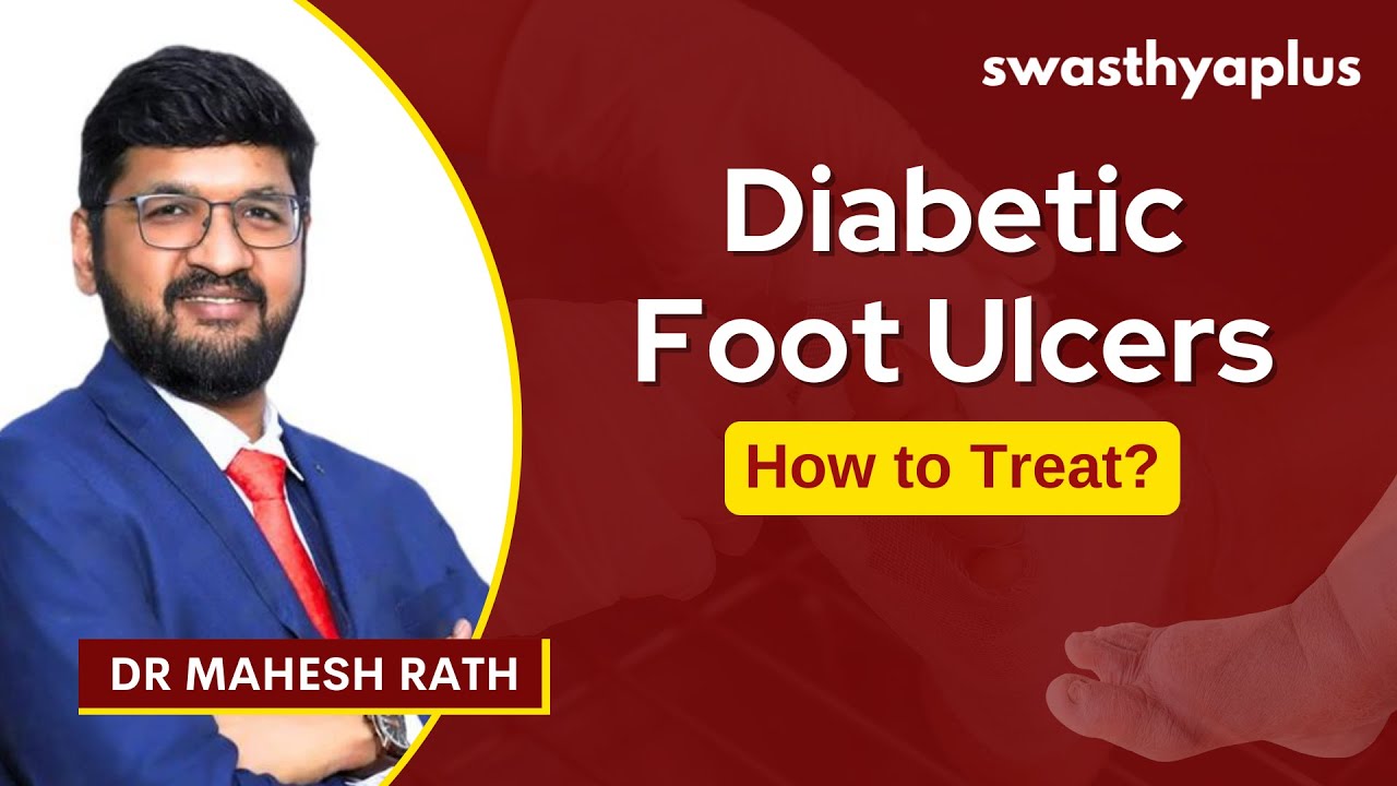Diabetic Foot Ulcers: How to Treat? | Causes & Symptoms | Prevention | Dr Mahesh Rath