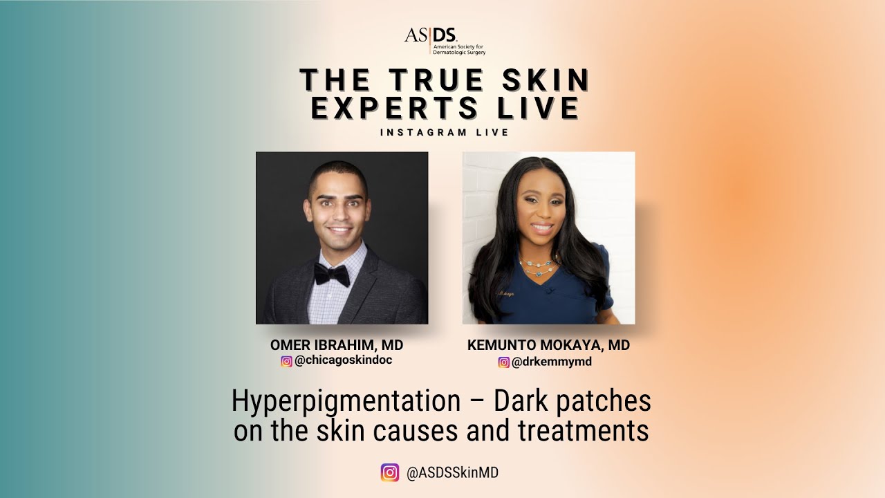 Hyperpigmentation – Dark Patches on the Skin Causes and Treatments