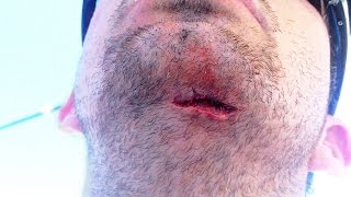 Fishing Rod smacks Fisherman - Fishing Fail