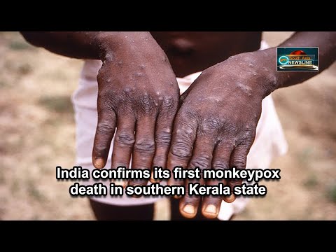India confirms its first monkeypox death in southern Kerala state